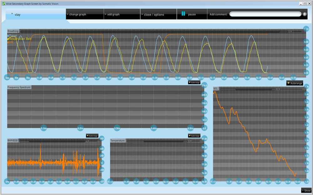 GP8 Respiratory Sensor Graphs